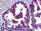MutS Homolog 6 antibody, LS-B5106, Lifespan Biosciences, Immunohistochemistry paraffin image 