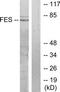 FES Proto-Oncogene, Tyrosine Kinase antibody, TA313401, Origene, Western Blot image 