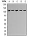 Adaptor Related Protein Complex 2 Subunit Beta 1 antibody, LS-C482336, Lifespan Biosciences, Western Blot image 
