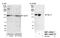 Phosphoinositide-3-Kinase Regulatory Subunit 4 antibody, NBP1-30463, Novus Biologicals, Western Blot image 