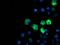 IlvB Acetolactate Synthase Like antibody, MA5-25585, Invitrogen Antibodies, Immunocytochemistry image 