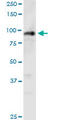 Polyhomeotic Homolog 1 antibody, LS-C197107, Lifespan Biosciences, Western Blot image 