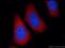 PH Domain And Leucine Rich Repeat Protein Phosphatase 2 antibody, 25244-1-AP, Proteintech Group, Immunofluorescence image 