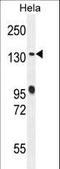 DENN Domain Containing 5A antibody, LS-C167358, Lifespan Biosciences, Western Blot image 