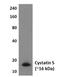 Cystatin-S antibody, GTX52685, GeneTex, Western Blot image 