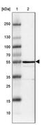 Ectonucleoside triphosphate diphosphohydrolase 5 antibody, PA5-51777, Invitrogen Antibodies, Western Blot image 