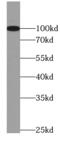 Cluster of Differentiation 10 antibody, FNab01406, FineTest, Western Blot image 