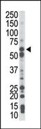 Phosphoenolpyruvate carboxylase antibody, AP15049PU-N, Origene, Western Blot image 