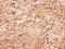 Afar antibody, GTX106613, GeneTex, Immunohistochemistry paraffin image 