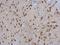 Ribosomal Protein L3 antibody, GTX114725, GeneTex, Immunohistochemistry paraffin image 