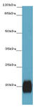 Zinc Finger Matrin-Type 5 antibody, A51265-100, Epigentek, Western Blot image 