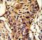 Branched Chain Keto Acid Dehydrogenase E1 Subunit Alpha antibody, LS-C156765, Lifespan Biosciences, Immunohistochemistry paraffin image 
