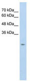 Solute Carrier Family 25 Member 45 antibody, TA334123, Origene, Western Blot image 