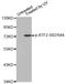 Activating Transcription Factor 2 antibody, STJ22021, St John