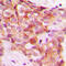 Collagen Type V Alpha 1 Chain antibody, GTX56153, GeneTex, Immunohistochemistry paraffin image 