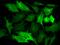 N-Myc Downstream Regulated 1 antibody, GTX02180, GeneTex, Immunocytochemistry image 