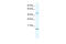 Ts Translation Elongation Factor, Mitochondrial antibody, 27-666, ProSci, Western Blot image 