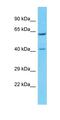 Pregnancy Specific Beta-1-Glycoprotein 8 antibody, orb325036, Biorbyt, Western Blot image 