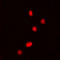 DEAD-Box Helicase 5 antibody, abx133132, Abbexa, Western Blot image 