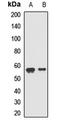 Lectin, Mannose Binding 1 antibody, LS-C667784, Lifespan Biosciences, Western Blot image 