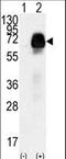 Anti-Mullerian Hormone Receptor Type 2 antibody, LS-C98098, Lifespan Biosciences, Western Blot image 