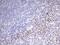 Integrin Subunit Beta 1 Binding Protein 1 antibody, MA5-26620, Invitrogen Antibodies, Immunohistochemistry paraffin image 