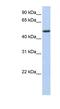 Pleckstrin Homology Like Domain Family A Member 1 antibody, NBP1-53065, Novus Biologicals, Western Blot image 