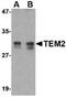 RASD Family Member 2 antibody, TA319864, Origene, Western Blot image 