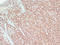 Tyrosinase antibody, LS-C744575, Lifespan Biosciences, Immunohistochemistry frozen image 