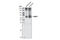 GLT-1 antibody, 3838S, Cell Signaling Technology, Western Blot image 