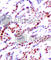 Activating Transcription Factor 2 antibody, AP0129, ABclonal Technology, Immunohistochemistry paraffin image 