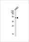 Autophagy Related 4A Cysteine Peptidase antibody, M06539-1, Boster Biological Technology, Western Blot image 