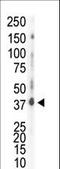 Casein Kinase 1 Delta antibody, LS-C100598, Lifespan Biosciences, Western Blot image 