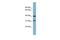 Ferric Chelate Reductase 1 Like antibody, GTX46377, GeneTex, Western Blot image 