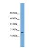 GSK3B Interacting Protein antibody, NBP1-79653, Novus Biologicals, Western Blot image 