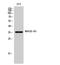 Melanoma-associated antigen 5 antibody, A17180, Boster Biological Technology, Western Blot image 