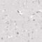 Coagulation Factor XIII B Chain antibody, PA5-52004, Invitrogen Antibodies, Immunohistochemistry paraffin image 