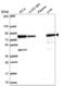 Hydroxyacyl-CoA Dehydrogenase Trifunctional Multienzyme Complex Subunit Alpha antibody, NBP2-54988, Novus Biologicals, Western Blot image 