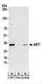 Activator Of Basal Transcription 1 antibody, NBP2-22333, Novus Biologicals, Western Blot image 