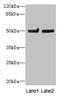 Tubulin Beta 6 Class V antibody, LS-C372191, Lifespan Biosciences, Western Blot image 