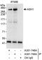 Achaete-Scute Family BHLH Transcription Factor 1 antibody, A301-748A, Bethyl Labs, Immunoprecipitation image 