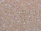 Methyl-CpG Binding Protein 2 antibody, CSB-PA440474, Cusabio, Immunohistochemistry paraffin image 