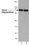 Thimet Oligopeptidase 1 antibody, MA5-24783, Invitrogen Antibodies, Western Blot image 