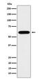 TUB Bipartite Transcription Factor antibody, M02917, Boster Biological Technology, Western Blot image 