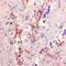 Aspergillus species antibody, MA1-74434, Invitrogen Antibodies, Immunohistochemistry frozen image 