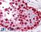 MAGE Family Member A1 antibody, LS-B1219, Lifespan Biosciences, Immunohistochemistry paraffin image 