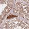 Pyruvate Dehydrogenase E1 Alpha 1 Subunit antibody, HPA063053, Atlas Antibodies, Immunohistochemistry paraffin image 