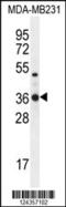Tryptase Delta 1 antibody, 55-222, ProSci, Western Blot image 