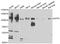 Dipeptidyl Peptidase 8 antibody, A05875, Boster Biological Technology, Western Blot image 