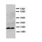 Interleukin 13 antibody, LS-C312629, Lifespan Biosciences, Western Blot image 